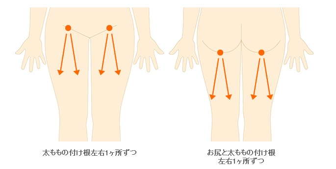 施術範囲目安