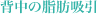 背中の脂肪吸引