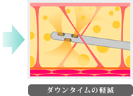 ダウンタイムの軽減