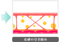 皮膚の引き締め
