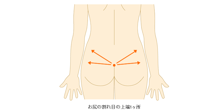 施術範囲目安