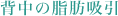 背中の脂肪吸引