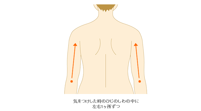 施術範囲目安