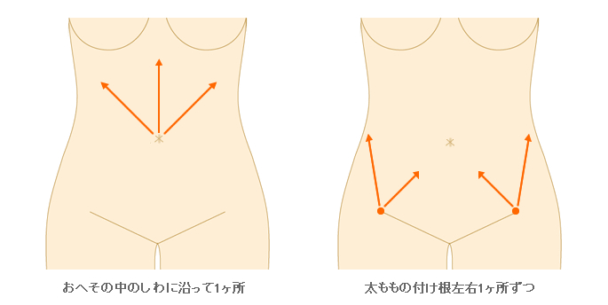 施術範囲目安